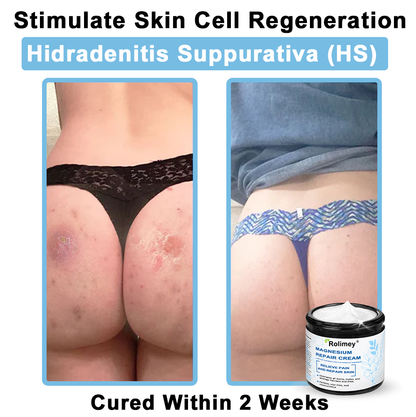 ✅Official Brand Shop丨 Rolimey® Magnesium Skin Repair Cream—Tightening for Skin Types