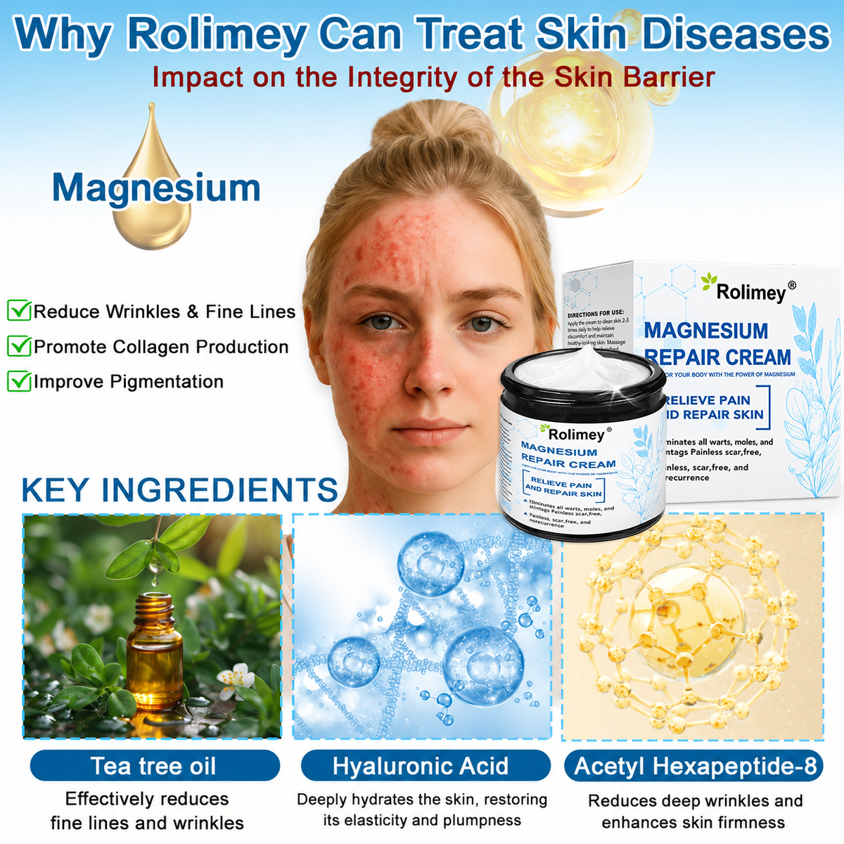✅Official Brand Shop丨 Rolimey® Magnesium Skin Repair Cream—Tightening for Skin Types